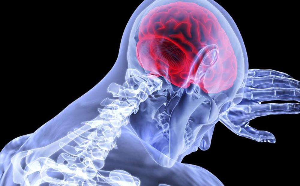 TBI Seizures slider